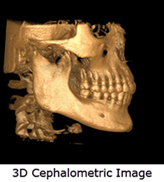 3D-Cephalometric